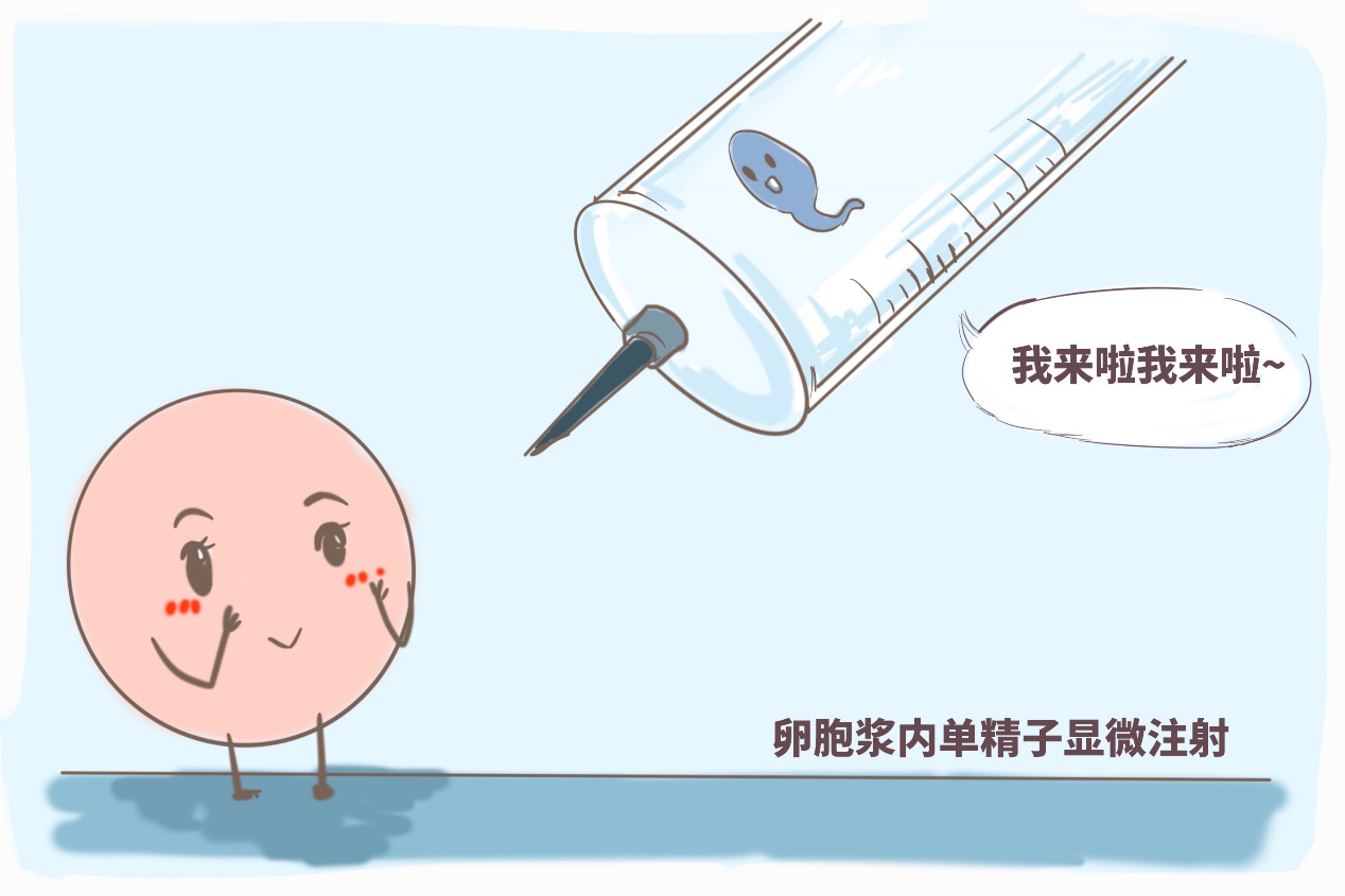 四个月引产
